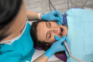 top view of female patient teeth whose teeth looks at dentist woman. Female dentist treats her patient