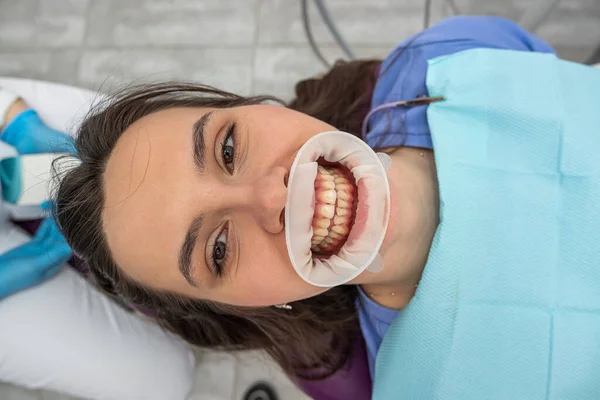 Top View Female Patient Teeth Whose Teeth Looks Dentist Woman — Fotografia de Stock