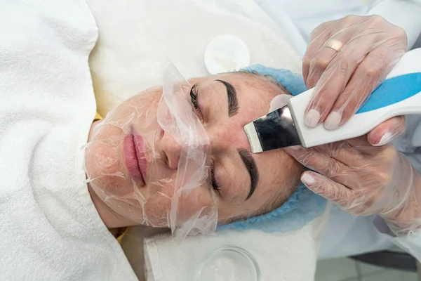 Beautician Brush Applies Photochemical Glycolic Peeling Mask Face Female Patient — Stock Photo, Image