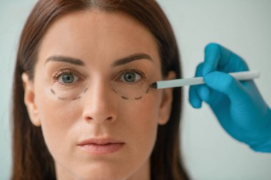 Plastik cerrah müşterilerin yüzüne çizgiler çiziyor