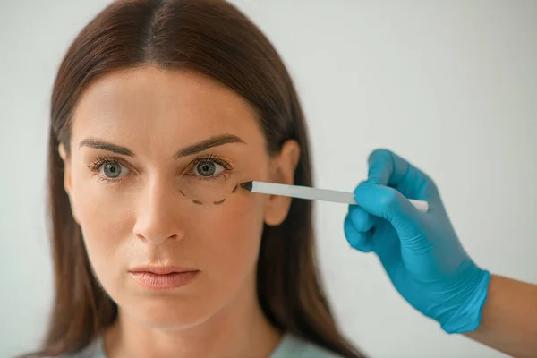Cirurgião plástico desenhando linhas no rosto dos clientes — Fotografia de Stock