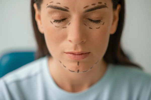 Una foto de una mujer con líneas para procedimientos de lifting facial —  Fotos de Stock