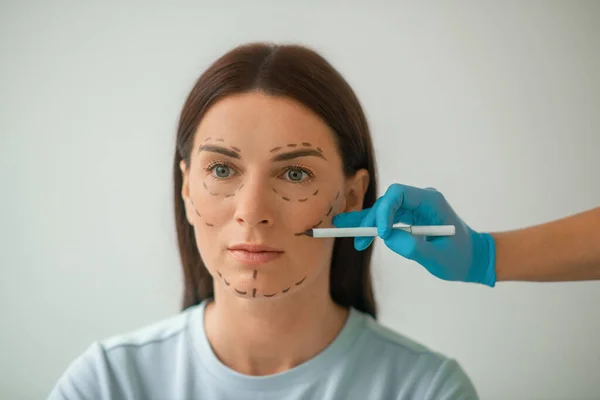 Um tiro na cabeça de uma mulher com linhas para procedimentos de levantamento de rosto — Fotografia de Stock