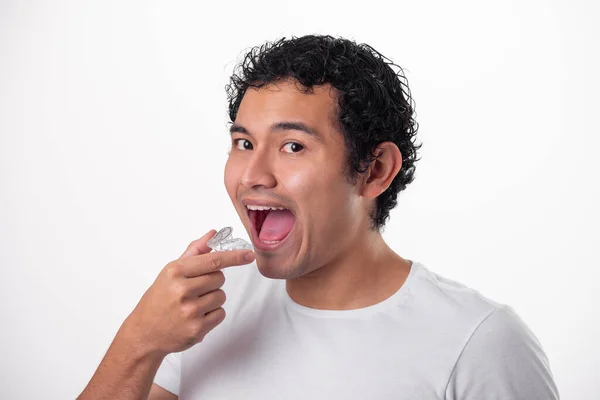 Joven Con Piel Oscura Mexicano Sostiene Mano Paladar Dental Procedimiento Fotos de stock