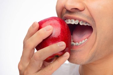 Kahverengi tenli İspanyol bir adam, diş telleriyle kırmızı bir elmayı ısırıyor, ortodontiyi kötüye kullanıyor, bir kişi