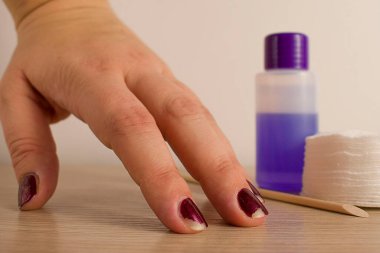 Zarar görmüş kadın manikürü. Tırnaklarıyla oje sürmüş. Ev manikürü konsepti. Karantinada ev manikürü. Kırılgan, kuru bir cilt. 