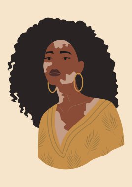 Vitiligo posterli genç siyahi kadın