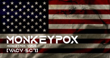 Maymun Çiçeği virüsü, Maymun Çiçeği virüsü, ABD 'de Maymun Çiçeği virüsü, ABD' de mesaj ve bayrak, Tıp ve Sağlık Konsepti.