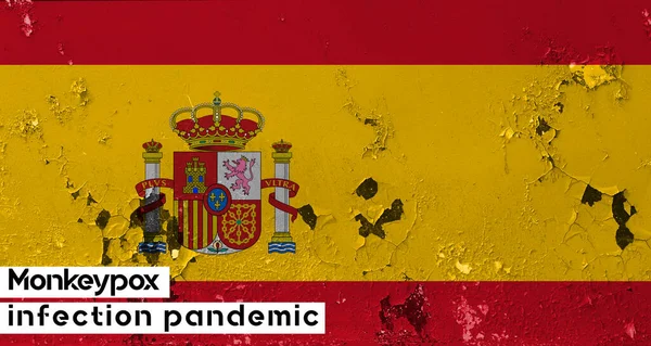 Monkeypox España España Bandera Con Bacterias Grietas Pandemia Infección Por — Foto de Stock