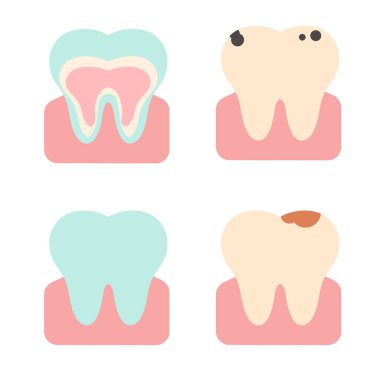 Farklı eyaletlerdeki vektör dişler. Düz Çizim