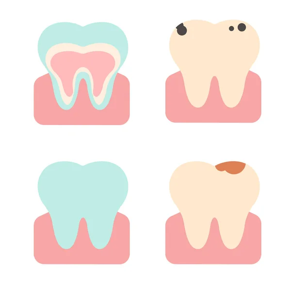 Vector Set Teeth Different States Flat Illustration — Διανυσματικό Αρχείο