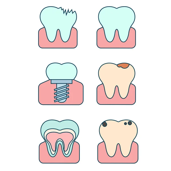 Διάνυσμα Επίπεδη Απεικόνιση Των Δοντιών Διάφορες Καταστάσεις Υγιές Άρρωστο Δόντι — Διανυσματικό Αρχείο