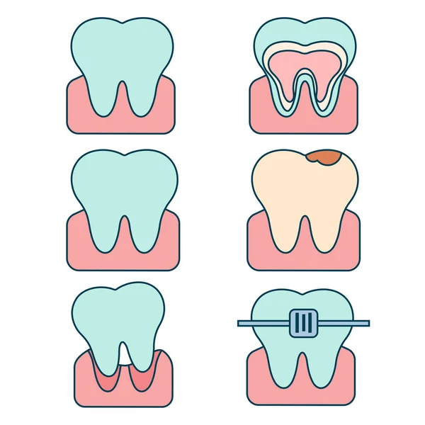 Set Teeth Various States Vector Flat Illustration — Διανυσματικό Αρχείο