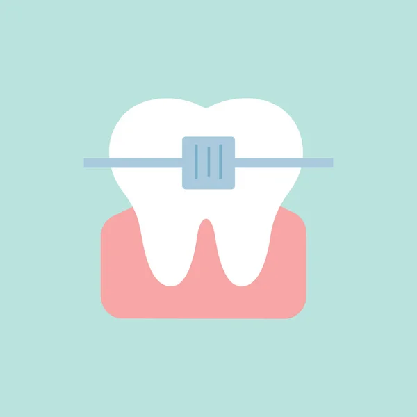 White Tooth Bracket System Vector Illustration — Stockvector