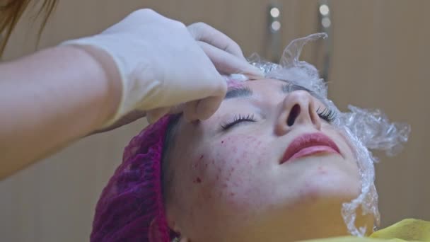 Conceito Beleza Injeção Cosmetologia Clínica Esteticista Experiente Usando Luvas Brancas — Vídeo de Stock