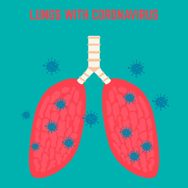 Coronavirüslü Insan Akciğeri Illüstrasyonu Wuhan Coronavirus Teması Poster Kart Pankart — Stok Vektör