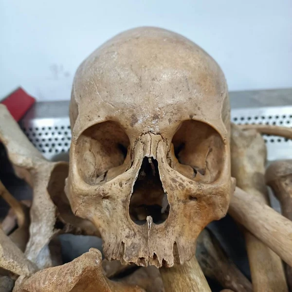 human skull with a skeleton head