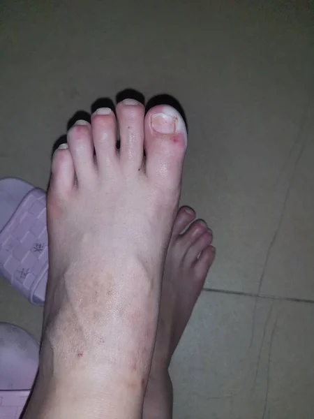 foot of a woman's feet
