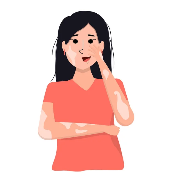 Illustration Vectorielle Une Jeune Femme Asiatique Souriante Avec Vitiligo Sur — Image vectorielle