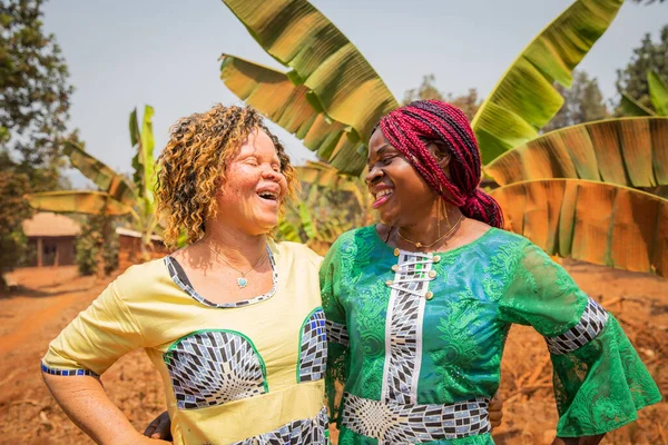 Две Африканские Подруги Смотрят Друг Друга Смеются Девушка Альбинос Своим — стоковое фото
