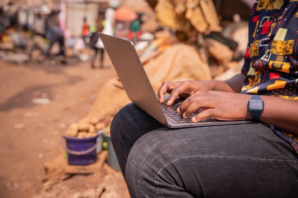 Zamknij Ręce Afrykańskiego Chłopca Pomocą Laptopa Podczas Gdy Rynku Technologia — Zdjęcie stockowe
