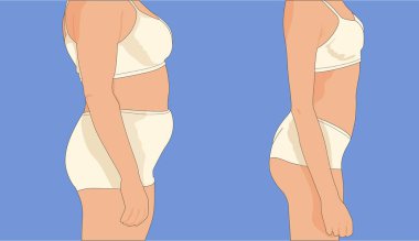 Öncesinde ve sonrasında bir kadın figürü. Vektör illüstrasyonu