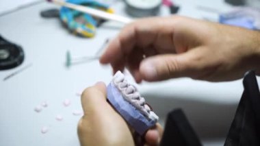 Diş kaplaması oluşturma ve diş teknisyeninin bıraktığı izlenim. yakın plan