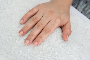 close-up detail of a girl's hand, placed on a white towel on the manicure table, right hand of a woman with untidy nails ready to start cleaning and painting in the beauty salon.