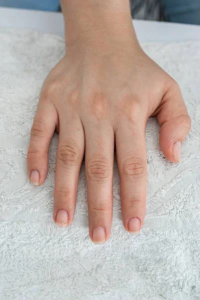 detail of a girl's hand, placed on a white towel on top of the manicure table, woman with untied nails ready to start cleaning and painting them