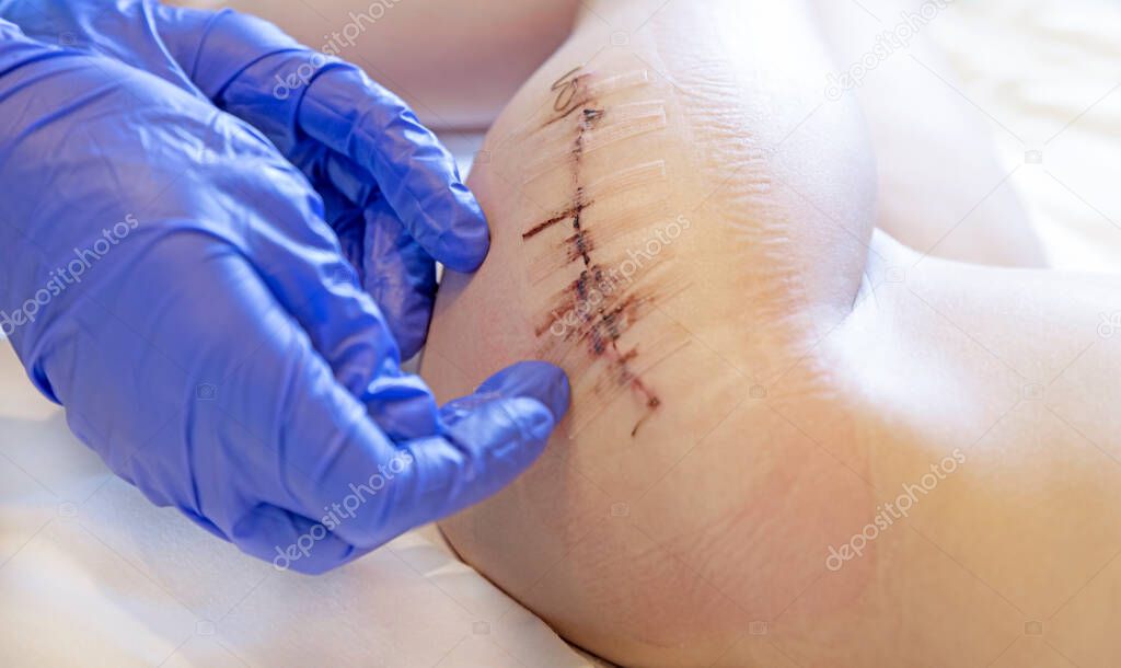 Hip surgery, pediatric surgery, surgeons hands examine the wound on the childs leg.