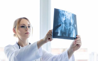 Cerrah parmağını x-ray resmine doğrultur. Kalça ekleminden ameliyat olması gerektiğini söyler.