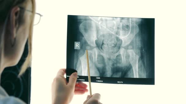 Close Female Doctor Examines Ray Surgery — Stockvideo