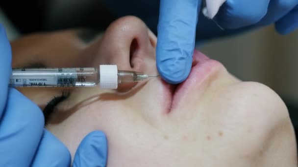 Close-up van de handen van de cosmetoloog die injectie in vrouwelijke lippen. Vrouw die schoonheidsinjectie krijgt voor lippen. Lipvergroting — Stockvideo