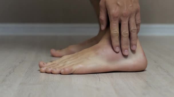 Крупним планом чоловіча нога з великим синяком, розтягуванням і травмою, торкається синяка — стокове відео