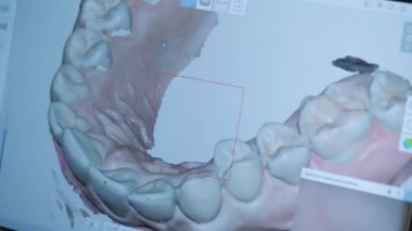 Doktor, dişçi kadın bir hastanın dişlerini tedavi için 3 boyutlu tarar.