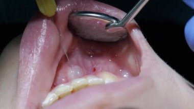 Yakın plan, dişçi diş tedavisinden önce kadın bir hastaya anestezi enjekte eder.