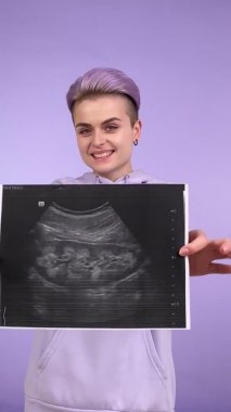 Hamilelik sırasında ultrason görüntüsü gösteren kısa saçlı neşeli, genç bir kadın karnına gülümseyen bir bebeğin ilk görüntüsünü yerleştiriyor. Mor arka planda izole edilmiş kapalı stüdyo görüntüleri.