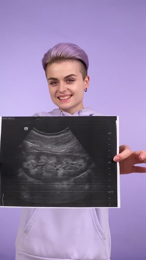 Hamilelik Sırasında Ultrason Görüntüsü Gösteren Kısa Saçlı Neşeli Genç Bir — Stok video