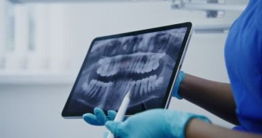 Bir dişçi, hastasına tablet kullanan bir diş fotoğrafını gösterir.