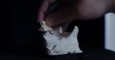 Ortodontist çeneyi birleştirerek oyuncu parçalarını ekler