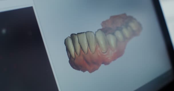 Detailní záběr monitoru v zubní ordinaci zobrazující 3D model čelisti — Stock video