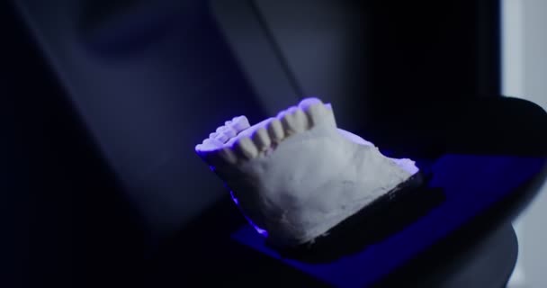 3D сканирование слепков челюсти для создания протезов — стоковое видео