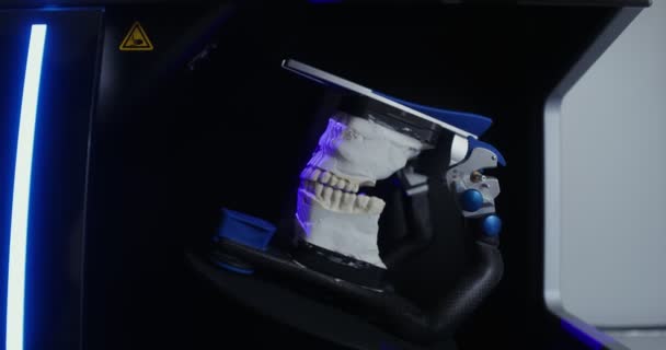 Digitalização 3D do elenco da mandíbula para criar dentaduras — Vídeo de Stock