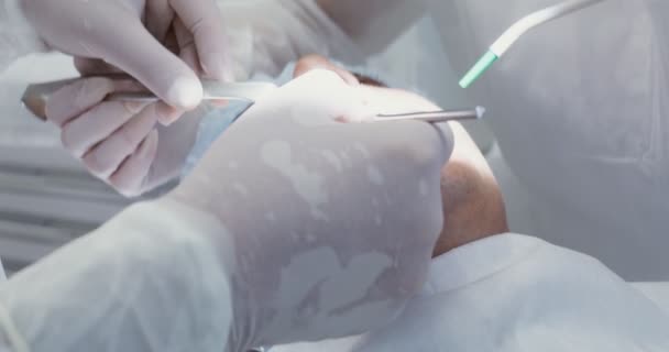 Modern bir klinikte diş tedavisi — Stok video
