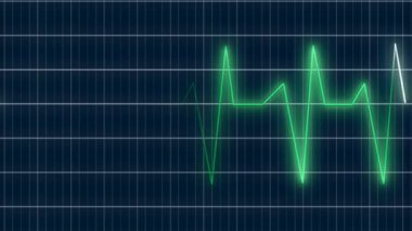 Renkli EKG Kalp Hızı Grafiği