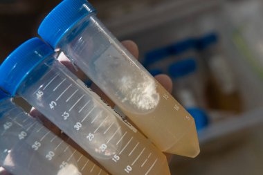 Santrifüj tüpü ve miselyumun gelişmesi için besin maddesi. Profesyonel mitoloji, mantar kültürü