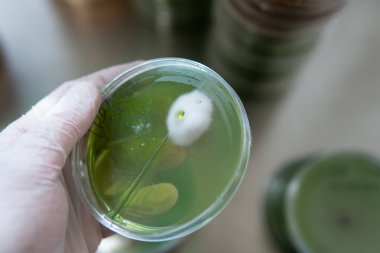 Egzotik tıbbi mantar ekimi. Mantar alımından dolayı zihinsel ve fiziksel sağlık. Mikoloji