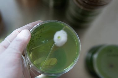 Miselyumun seçilmesi ve yetiştirilmesi. Dünya çapında mantar yetiştirme