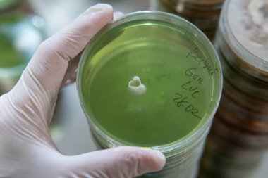 Agar 'lı petri kapları. Mikoloji ve Miselyum