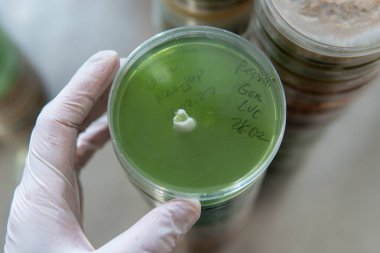 Petri kabında miselyum egzotik mantar. Miselyumun seçilmesi ve yetiştirilmesi. Dünya çapında mantar yetiştirme